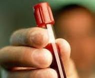 Анализ крови рпга: расшифровка результатов